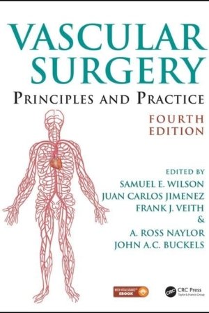 Vascular Surgery: Principles and Practice 4E PDF