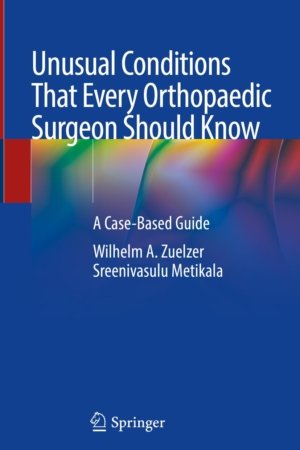 Unusual Conditions That Every Orthopedic Surgeon Should Know PDF