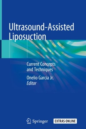 Ultrasound-Assisted Liposuction PDF