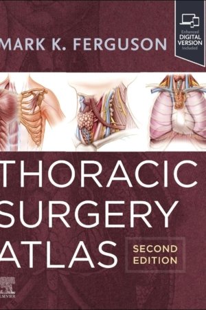Thoracic Surgery Atlas 2E PDF