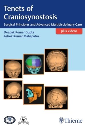 Tenets of Craniosynostosis PDF