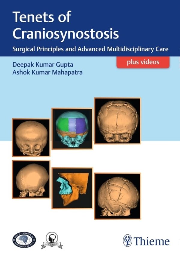Tenets of Craniosynostosis PDF
