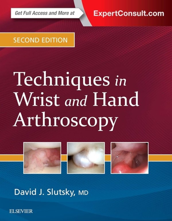 Techniques in Wrist and Hand Arthroscopy 2E PDF