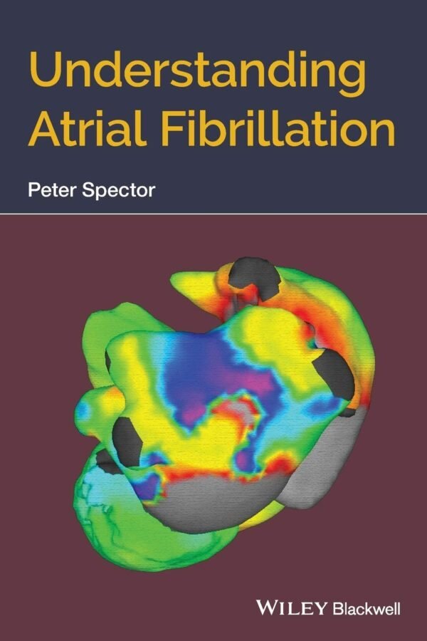 Understanding Atrial Fibrillation PDF