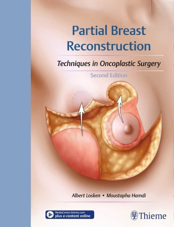 Partial Breast Reconstruction: Techniques in Oncoplastic Surgery 2E PDF