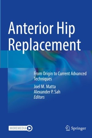 Anterior Hip Replacement PDF