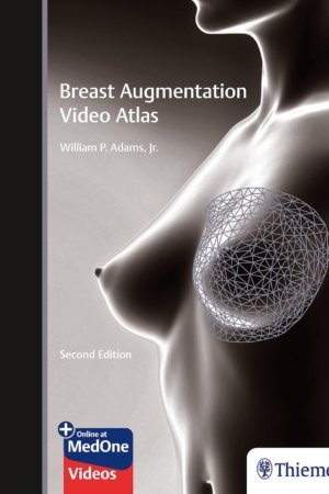 Breast Augmentation Video Atlas 2E PDF
