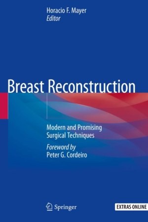Breast Reconstruction: Modern and Promising Surgical Techniques PDF