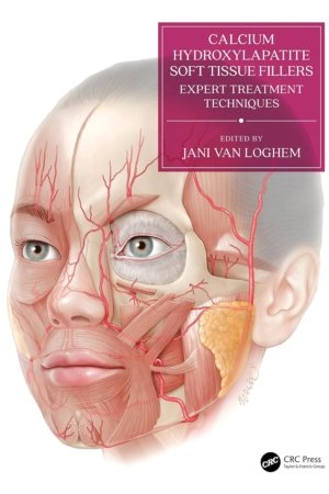Calcium Hydroxylapatite Soft Tissue Fillers PDF