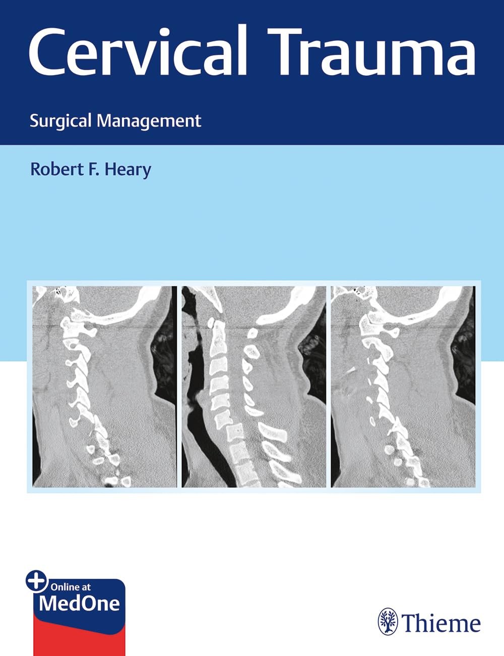 Cervical Trauma: Surgical Management PDF