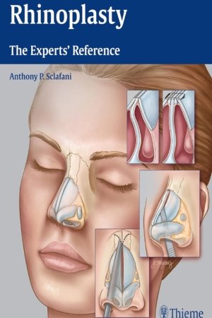 Rhinoplasty: The Experts' Reference PDF