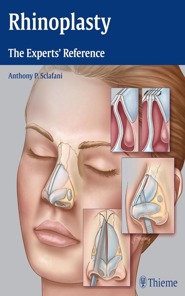 Rhinoplasty: The Experts' Reference PDF