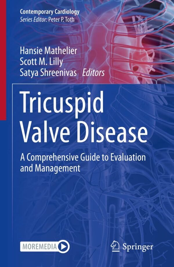 Tricuspid Valve Disease PDF