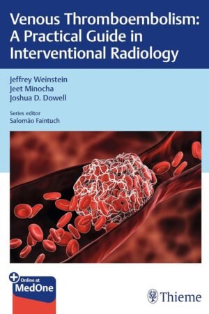 Venous Thromboembolism: A Practical Guide in Interventional Radiology