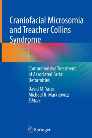 Craniofacial Microsomia and Treacher Collins Syndrome PDF