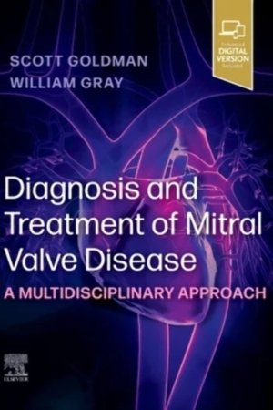 Diagnosis and Treatment of Mitral Valve Disease PDF