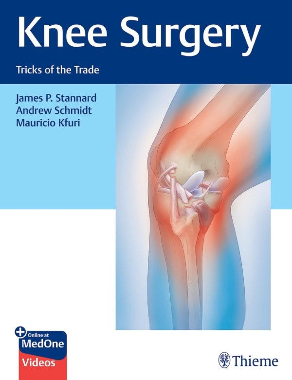 Knee Surgery Tricks of the Trade PDF