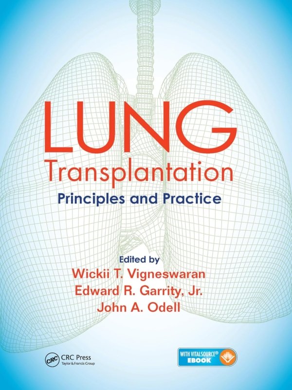 Lung Transplantation: Principles and Practice PDF