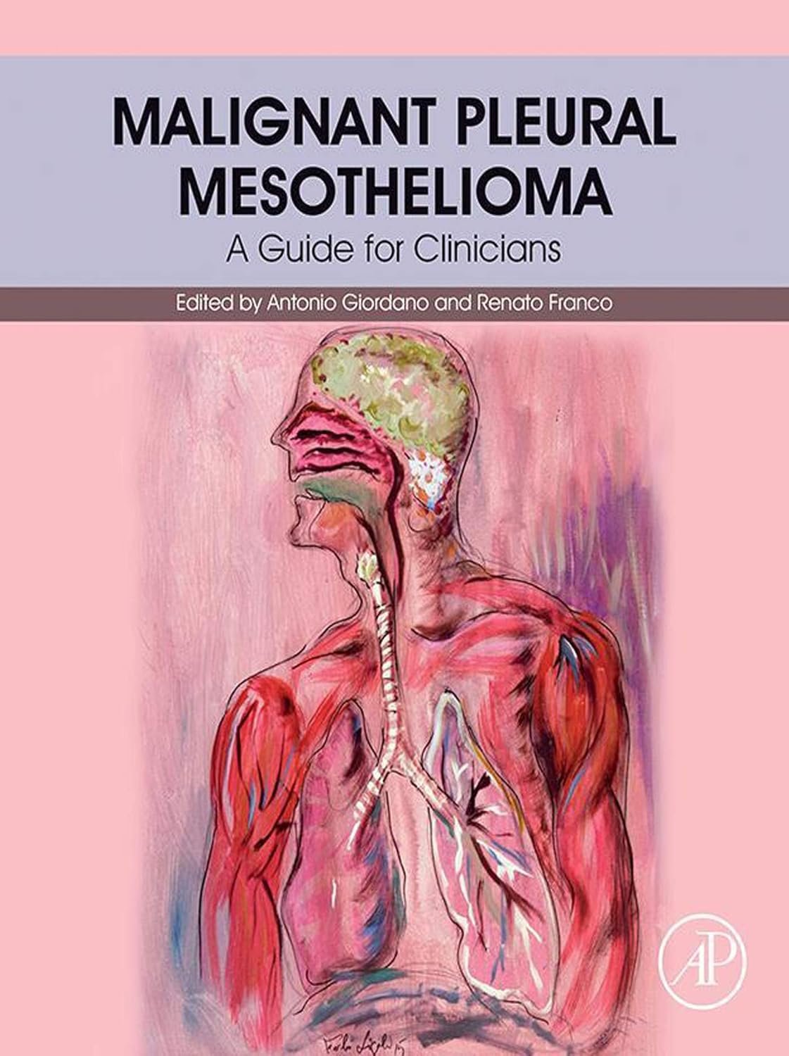 Malignant Pleural Mesothelioma PDF