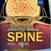 Diagnostic Imaging: Spine 5E
