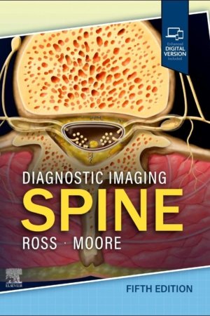 Diagnostic Imaging: Spine 5E
