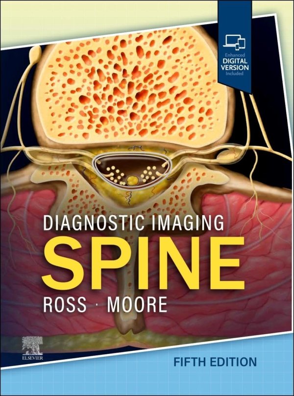 Diagnostic Imaging: Spine 5E