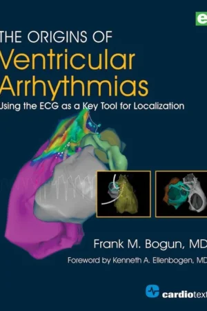 The Origins of Ventricular Arrhythmias Volume 1