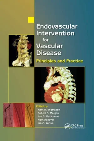 Endovascular Intervention for Vascular Disease Principles and Practice