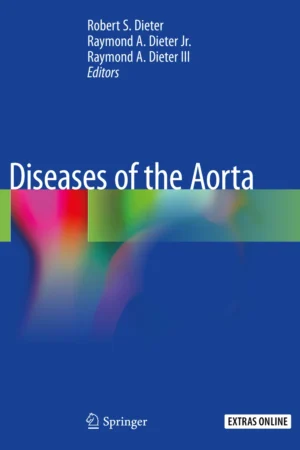 Diseases of the Aorta