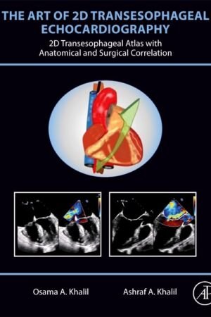 The Art of 2D Transesophageal Echocardiography