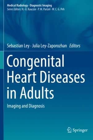 Congenital Heart Diseases in Adults