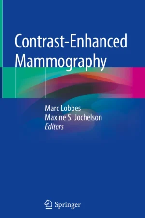 Contrast-Enhanced Mammography PDF