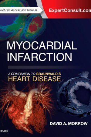 Myocardial Infarction: A Companion to Braunwald's Heart Disease