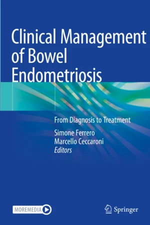 Clinical Management of Bowel Endometriosis PDF