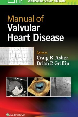 Manual of Valvular Heart Disease