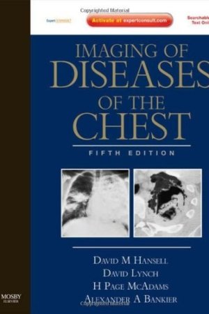 Imaging of Diseases of the Chest: Expert Consult – Online and Print 5th Edition PDF