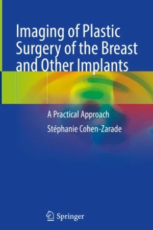 Imaging of Plastic Surgery of the Breast and Other Implants: A Practical Approach PDF