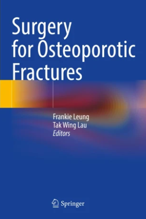 Surgery for Osteoporotic Fractures PDF