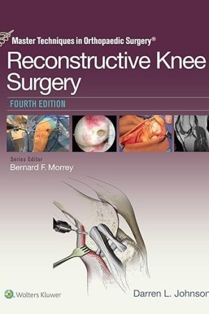 Master Techniques in Orthopaedic Surgery: Reconstructive Knee Surgery 4e PDF