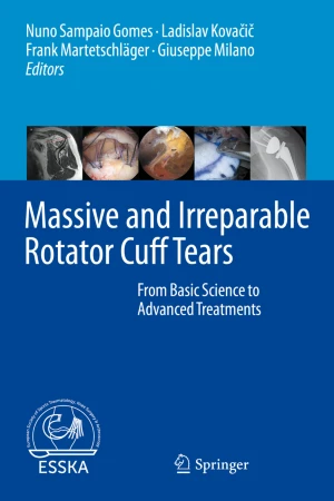 Massive and Irreparable Rotator Cuff Tears: From Basic Science to Advanced Treatments PDF