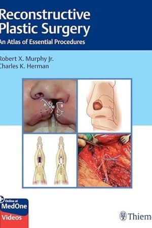 Reconstructive Plastic Surgery: An Atlas of Essential Procedures 1st Edition PDF