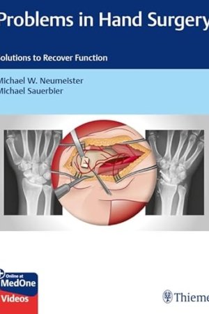 Problems in Hand Surgery: Solutions to Recover Function 1st Edition PDF