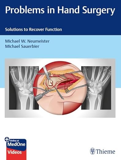 Problems in Hand Surgery: Solutions to Recover Function 1st Edition PDF