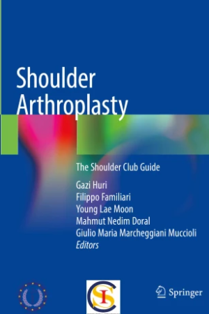 Shoulder Arthroplasty PDF