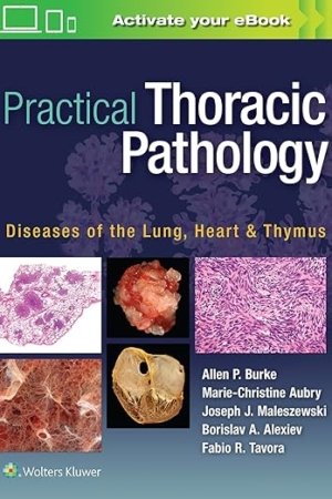 Practical Thoracic Pathology: Diseases of the Lung, Heart, and Thymus First Edition PDF