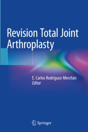 Revision Total Joint Arthroplasty PDF