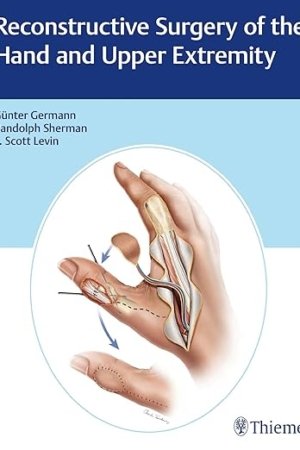 Reconstructive Surgery of the Hand and Upper Extremity PDF