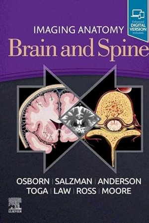 Imaging Anatomy Brain and Spine 1E PDF