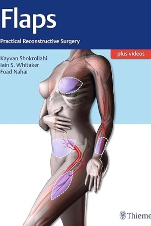 Flaps: Practical Reconstructive Surgery PDF