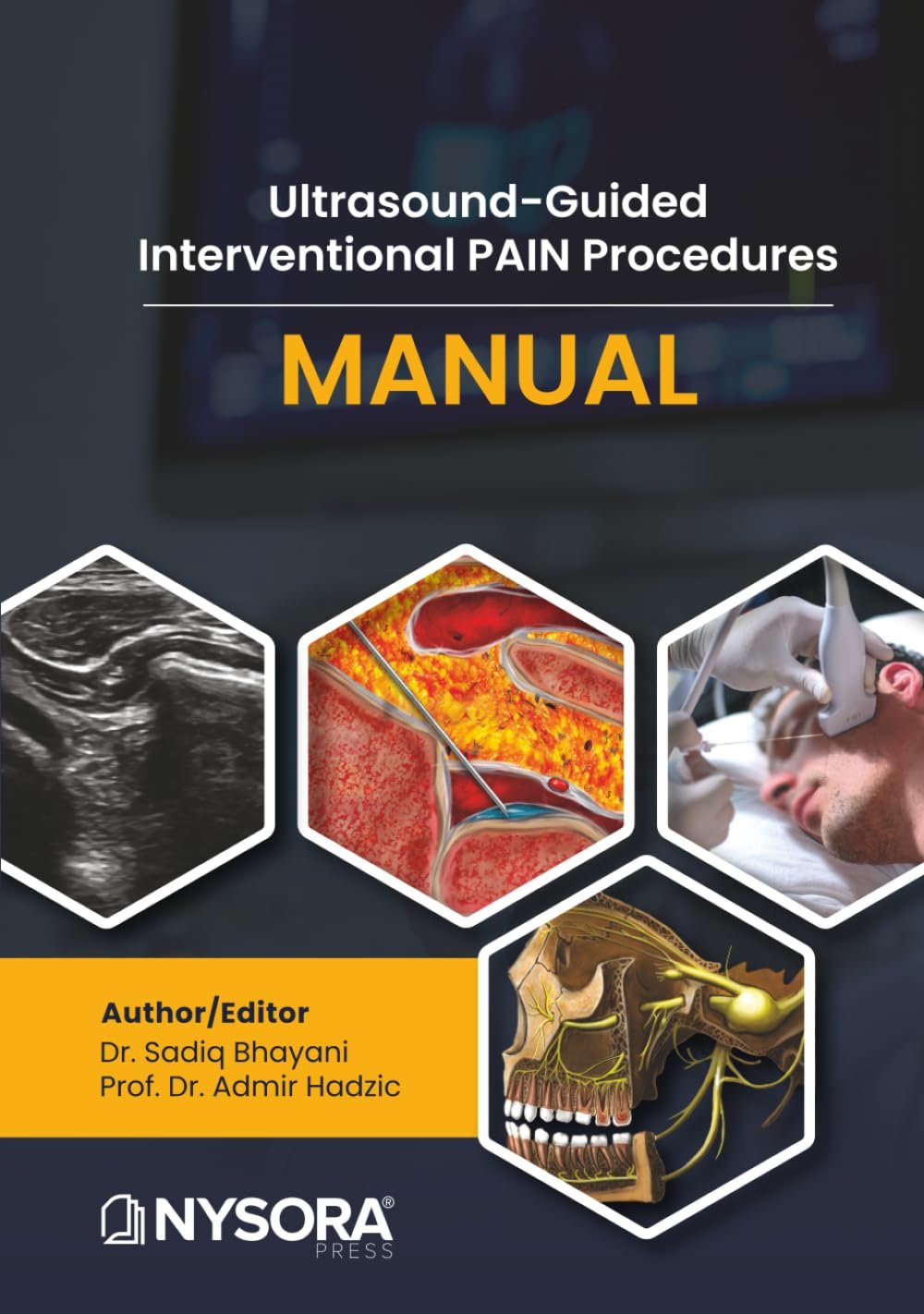 Ultrasound-Guided Interventional Pain Procedures Manual PDF + 48 Videos 4K